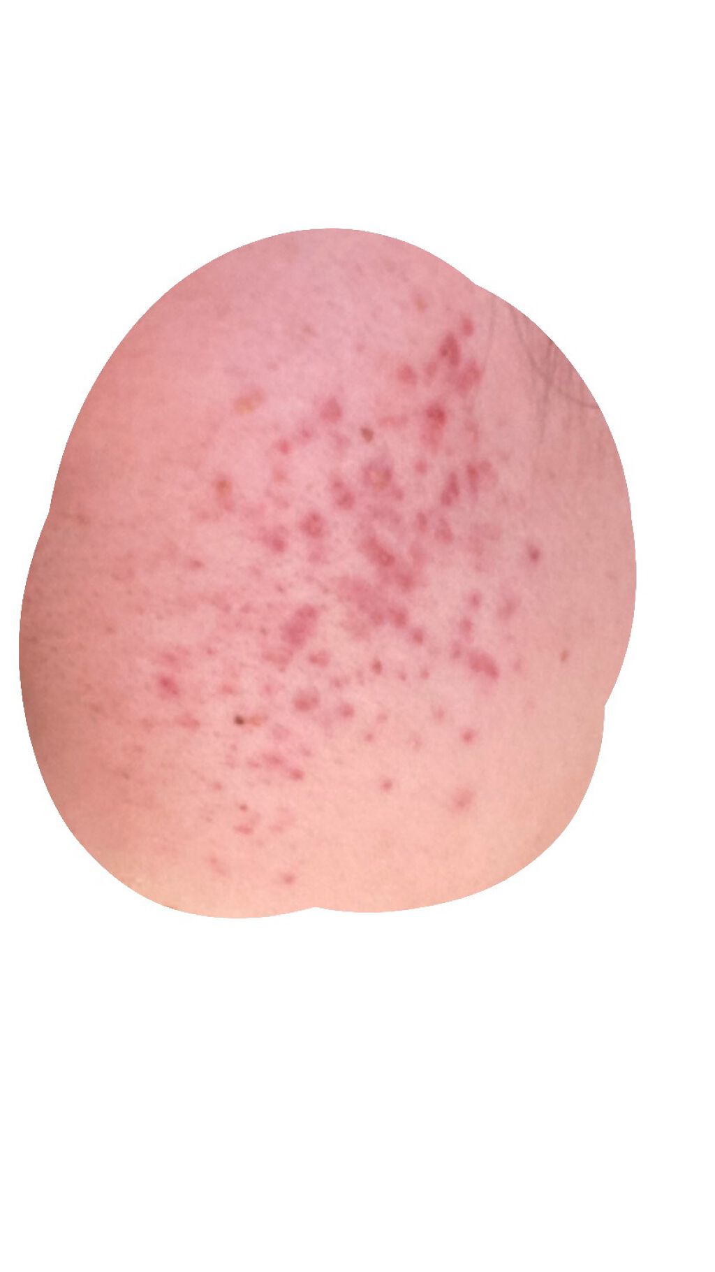 pink_sounds_dlm on LIPS 「少しはましになった方ですか?早く治る方法があれば教えてください..」(2枚目)