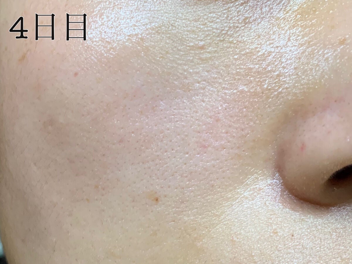 RXザ・ビタミンC23セラム/COSRX/美容液を使ったクチコミ(3枚目)