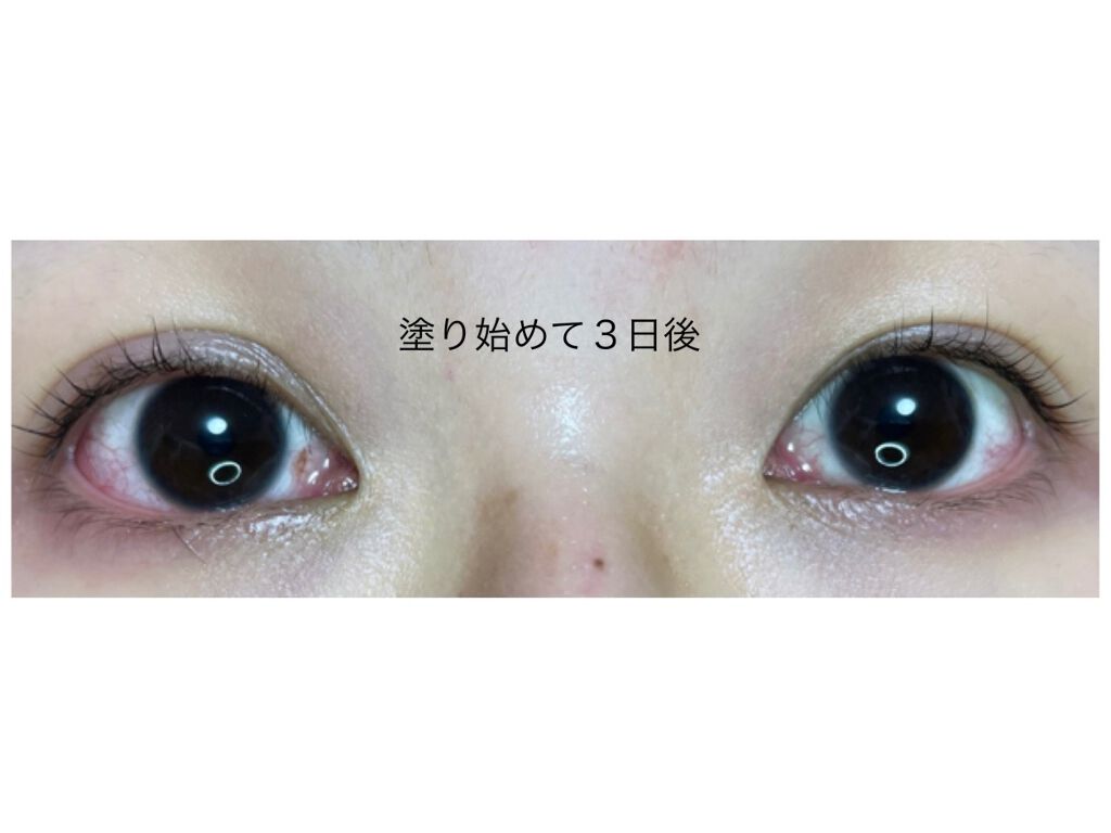 EMAKED（エマーキット）/水橋保寿堂製薬/まつげ美容液を使ったクチコミ（3枚目）