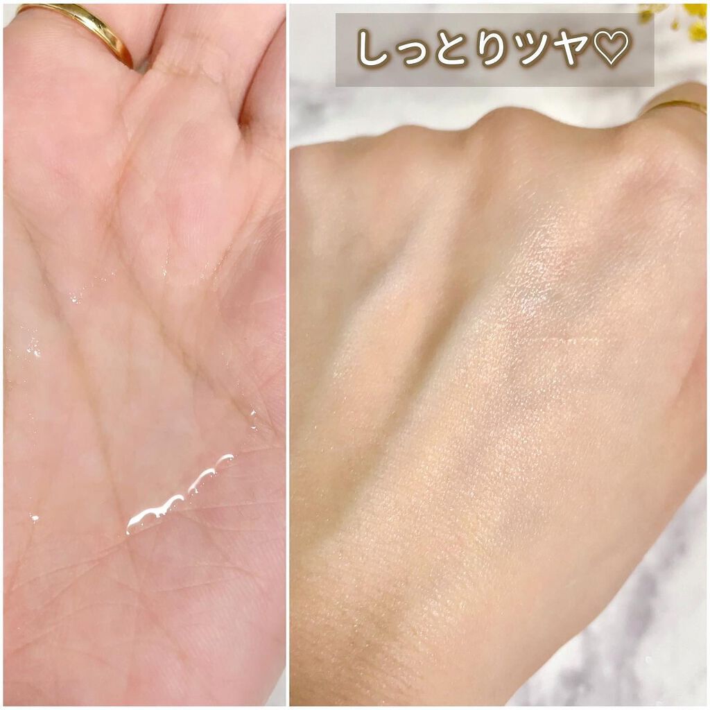 VC100エッセンスローション EX/ドクターシーラボⓇ/化粧水を使ったクチコミ(5枚目)