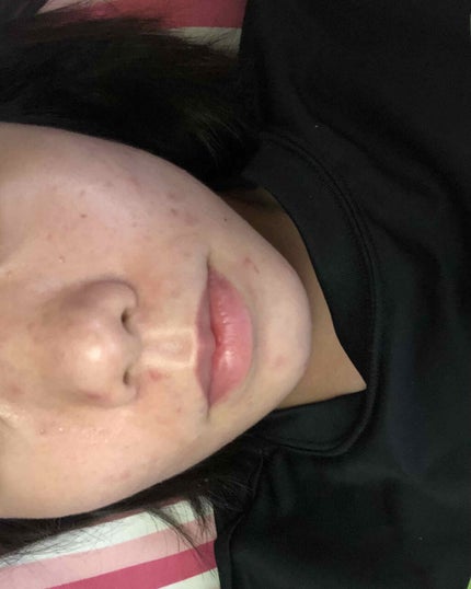 香織 on LIPS 「助けてください…高校3年生の香織(カオリ)です🌱𓂃𓈒𓏸オイリー..」(3枚目)