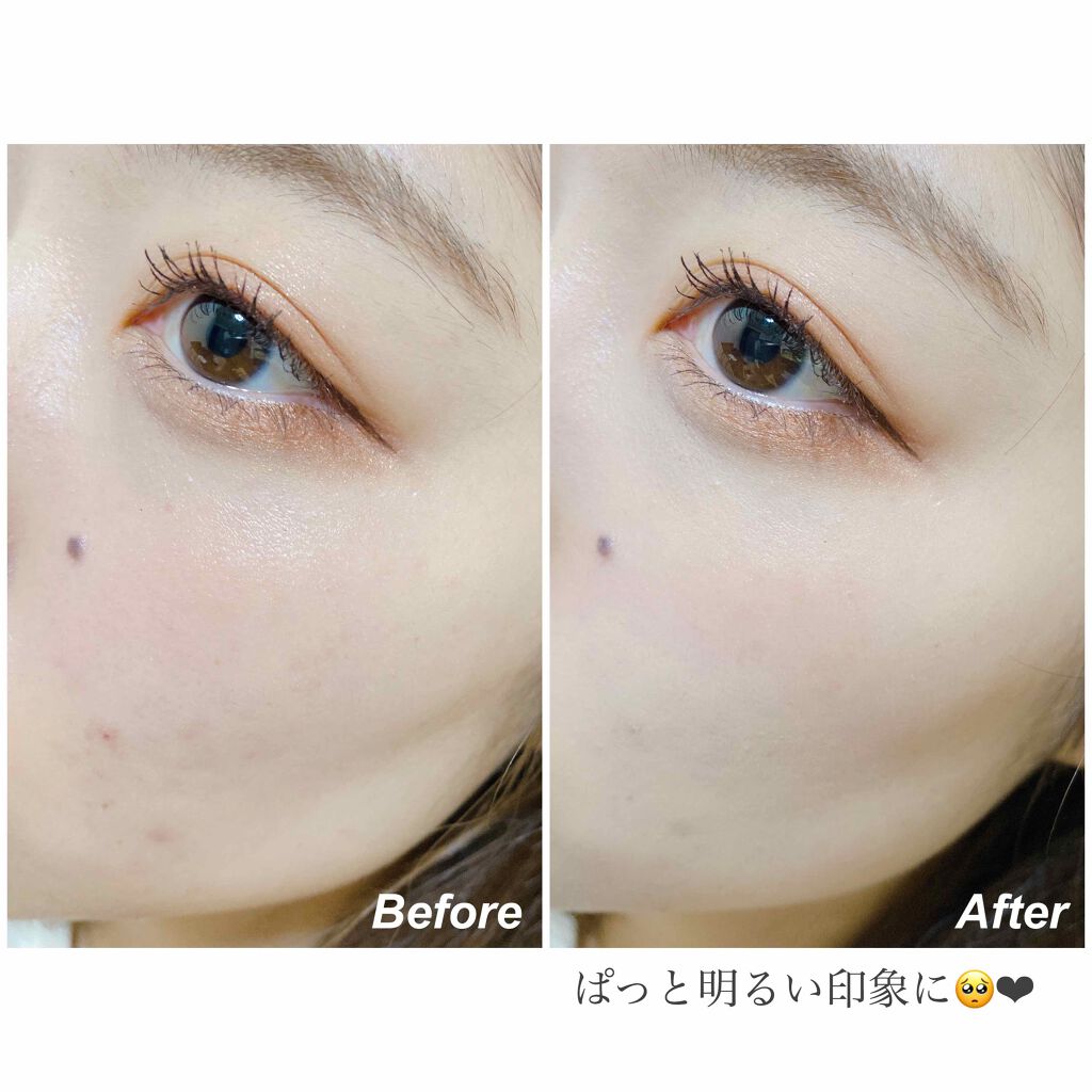 マジックコンシーラー イエローベージュ/カリプソ/リキッドコンシーラーを使ったクチコミ（3枚目）