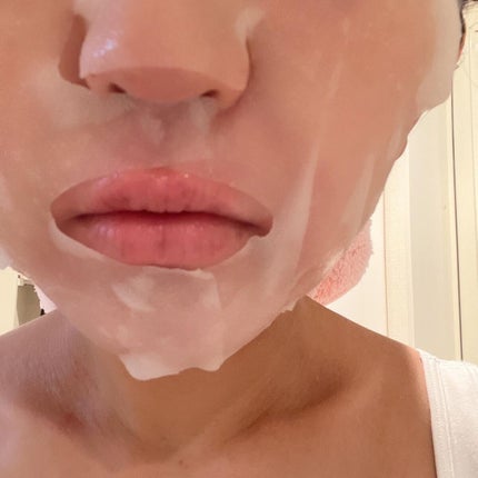 スキントラブルケア マスク/アルージェ/シートマスク・パックを使ったクチコミ(3枚目)