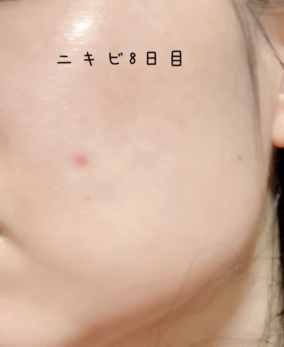 RMK Wトリートメントオイル/RMK/ブースター・導入液を使ったクチコミ（1枚目）