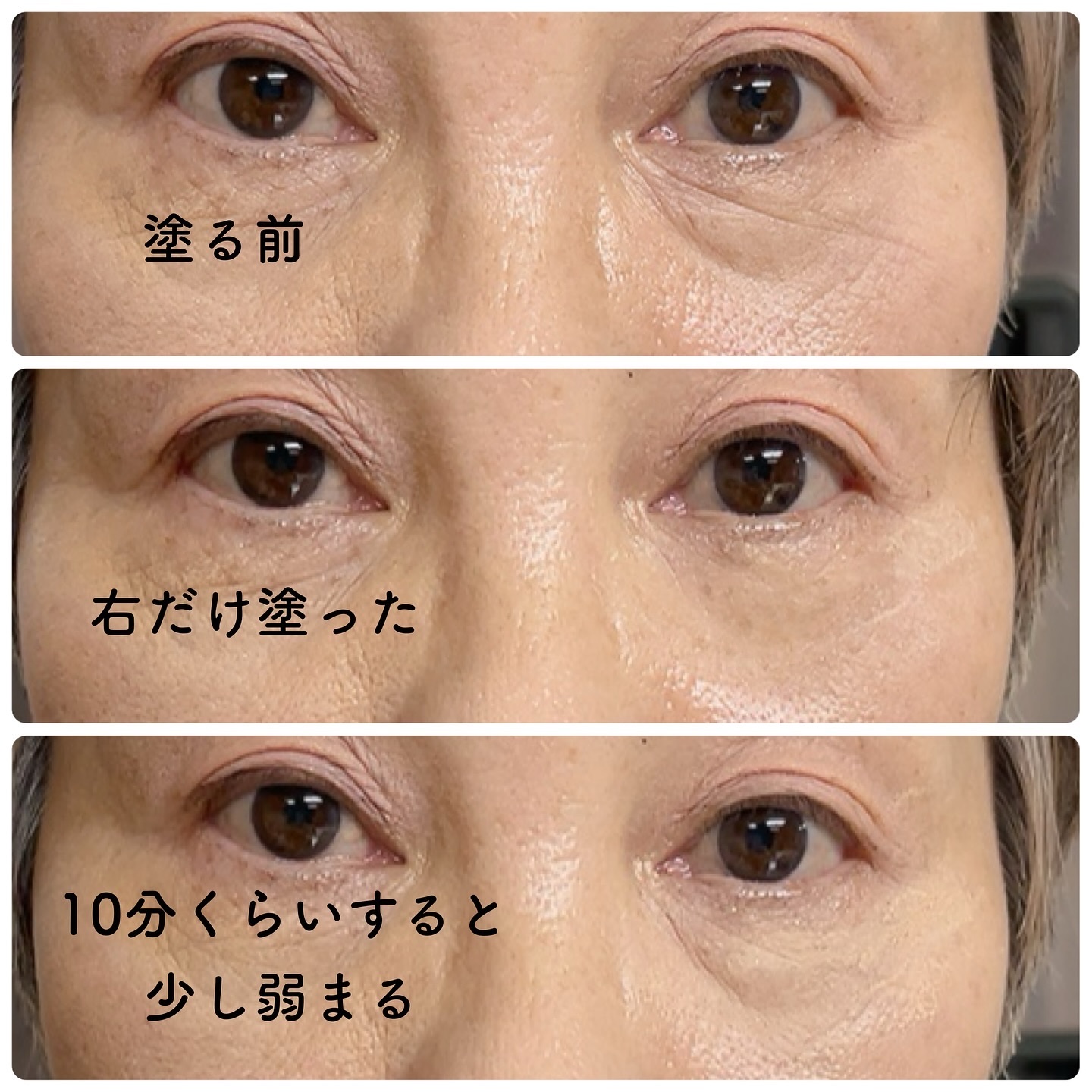 ドクターメラクチン.アイファルト アイバッククリーム Dr.Melaxin 正規取扱店 ⁄ 国内発送 アイファルト アイ