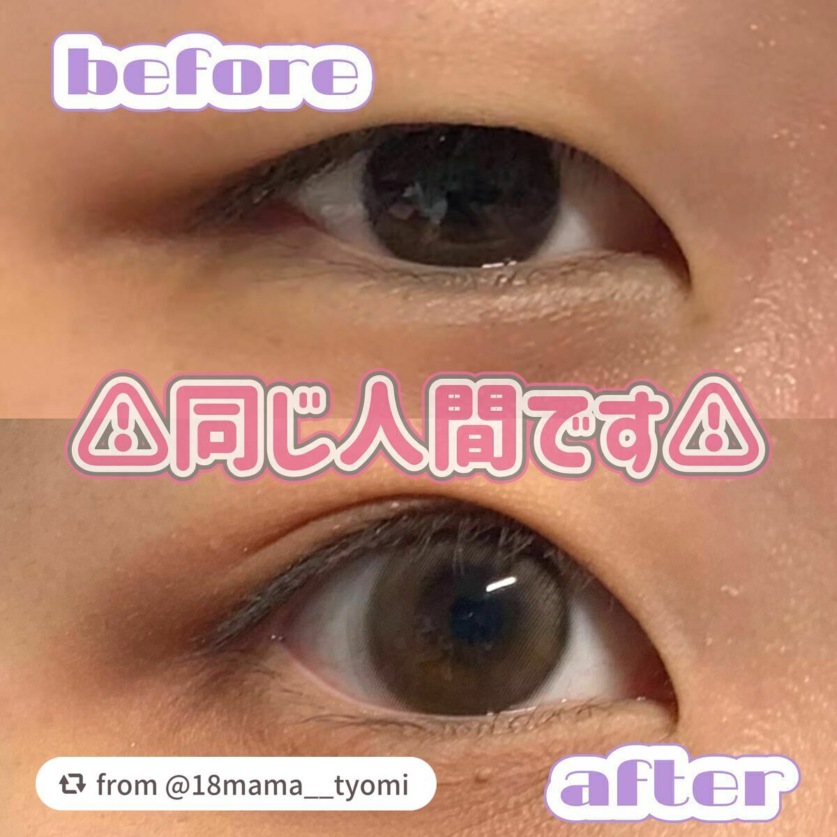 ハイブリッドフィルム スーパーマット/アイトーク/二重まぶた用アイテムを使ったクチコミ(1枚目)