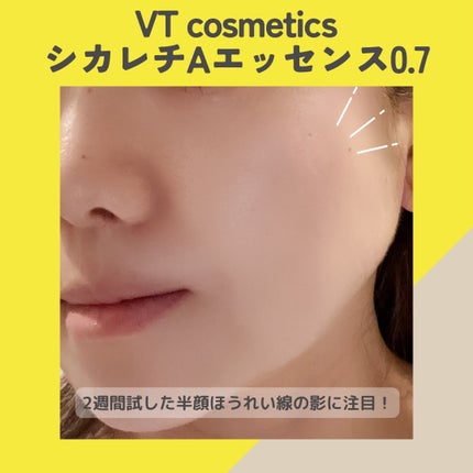 シカレチA エッセンス0.7/VT/美容液を使ったクチコミ(6枚目)