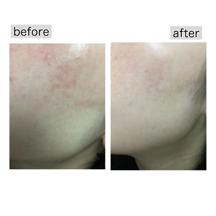 弱酸性レッドブレミッシュクリアスージングフォーム/Dr.G/洗顔フォームを使ったクチコミ(4枚目)