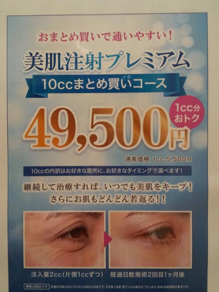 åå·ã¹ãã³ã¯ãªããã¯/ããŒãã©ã³ã/ãã®ä»ã䜿ã£ãã¯ãã³ãïŒ1æç®ïŒ