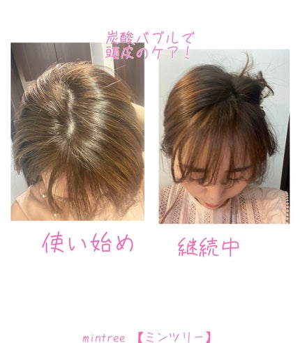 スパークリングスカルプスケーラー/ミンツリー/頭皮ケアを使ったクチコミ(3枚目)