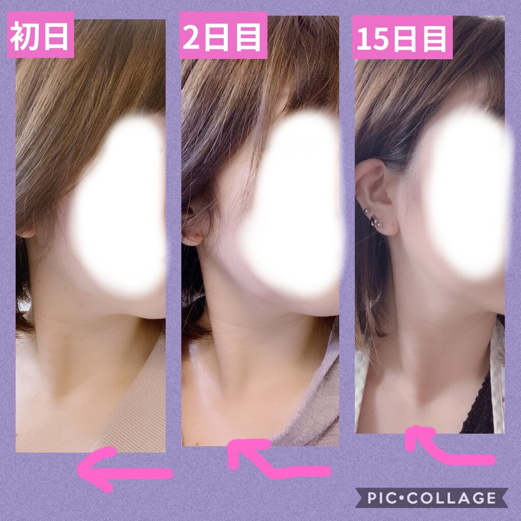 VONMIE ニコベルト | www.tspea.org