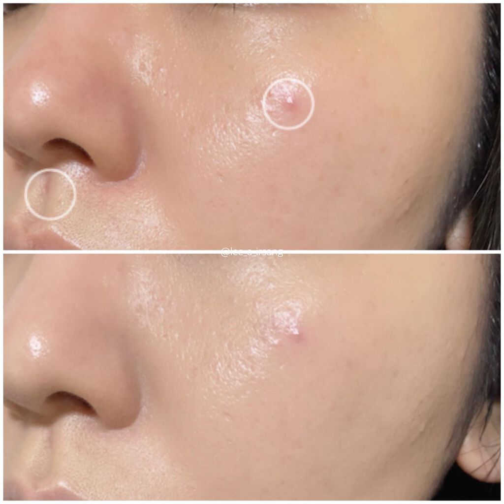 シカマヌ セラム クッションファンデ/parnell/クッションファンデーションを使ったクチコミ(5枚目)