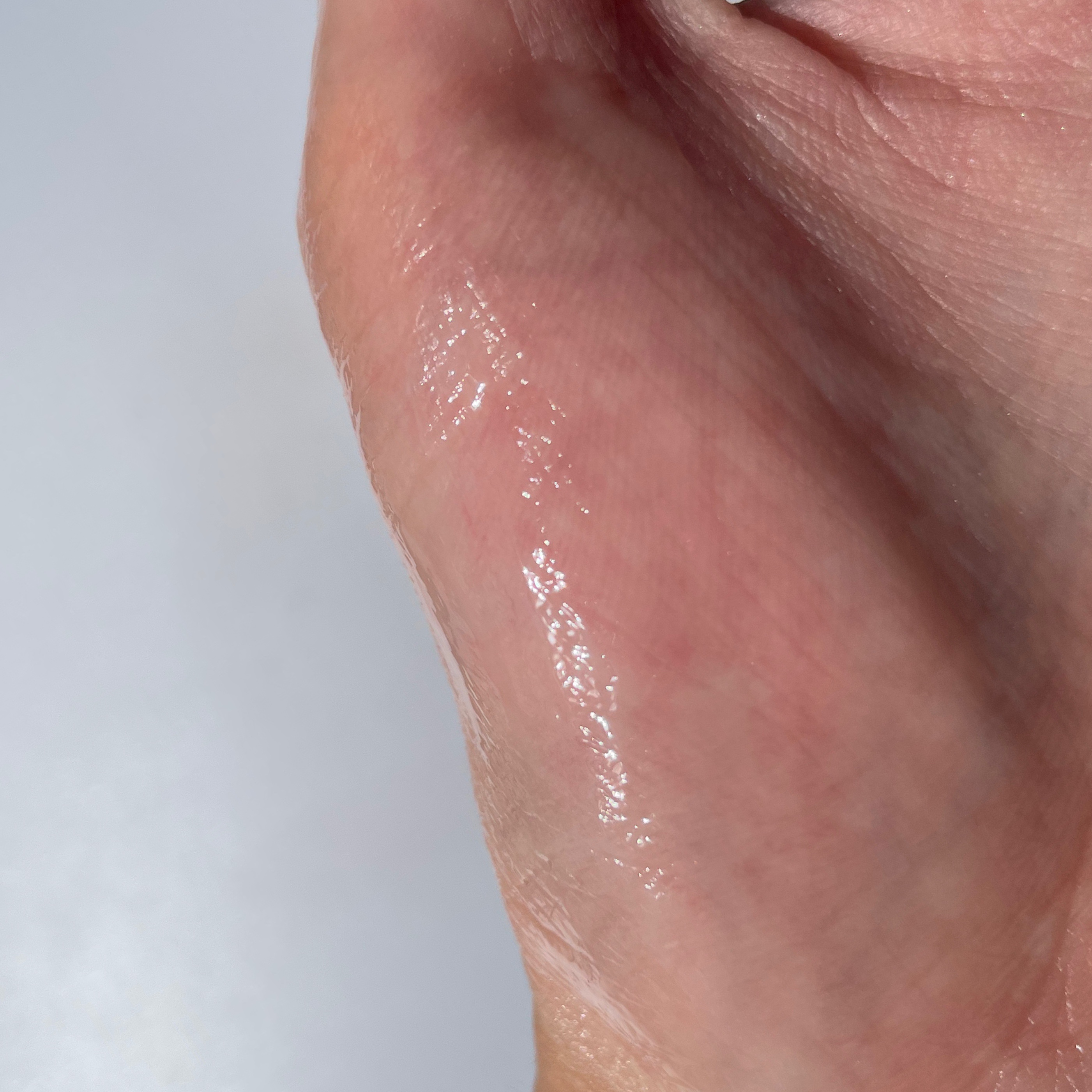 リードルショット100/VT/美容液を使ったクチコミ（3枚目）