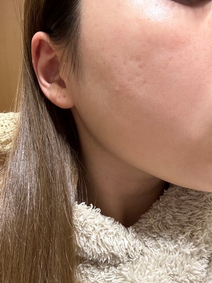 明色美顔水 薬用化粧水/美顔/化粧水を使ったクチコミ(2枚目)