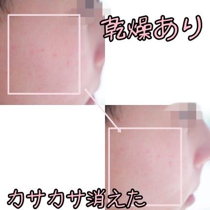 VIR TOKYO BALANCE LOTION/VIR TOKYO/オールインワン化粧品を使ったクチコミ(6枚目)