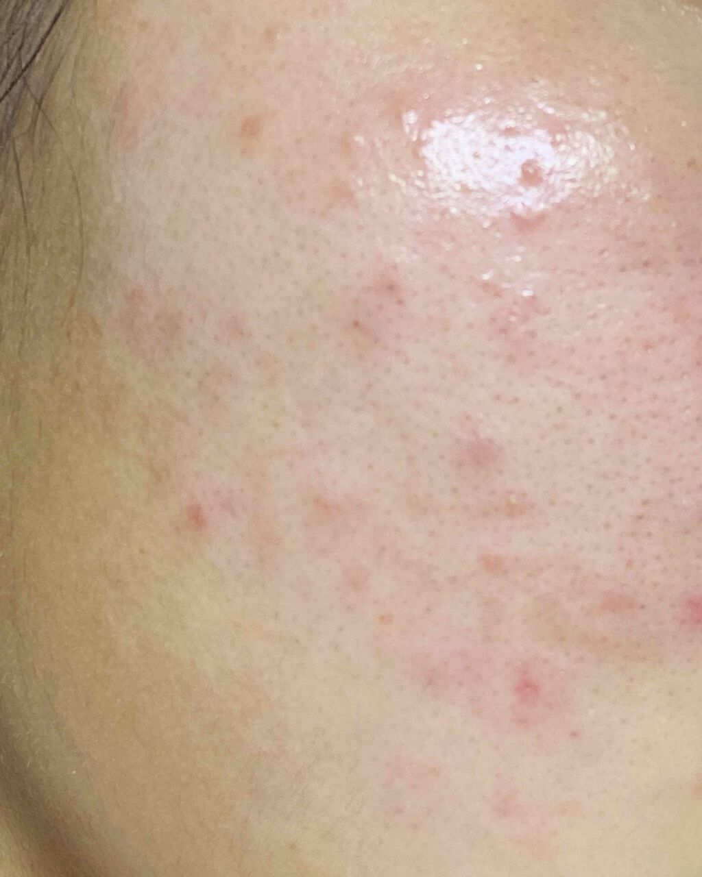 ロゼット洗顔パスタ アクネクリア/ロゼット/洗顔フォームを使ったクチコミ(3枚目)