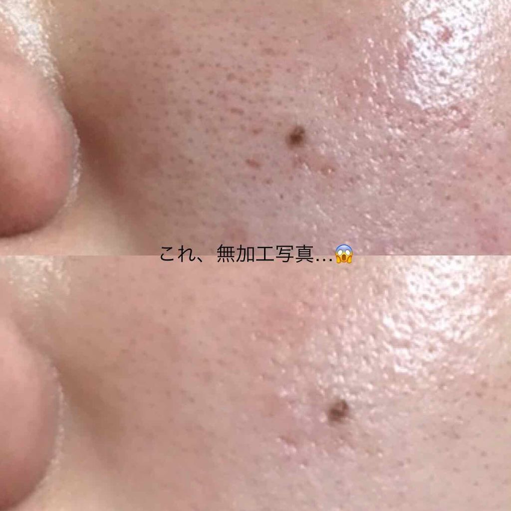 フェイシャル トリートメント エッセンス/SK-II/化粧水を使ったクチコミ(1枚目)