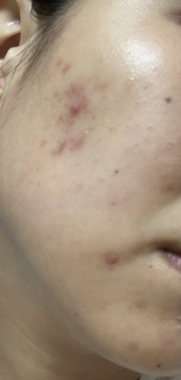 ビタミンミルク/ASUNE /乳液を使ったクチコミ（2枚目）