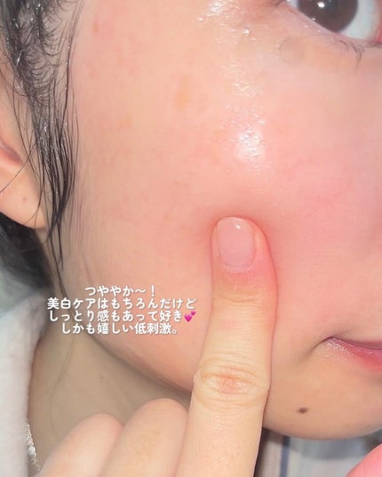 ガラクトミセスピュアビタミンCグローセラム/SOME BY MI/美容液を使ったクチコミ(4枚目)