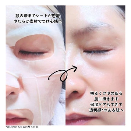 8デイズピュアビタミンCアンプル/VARI:HOPE/美容液を使ったクチコミ(6枚目)