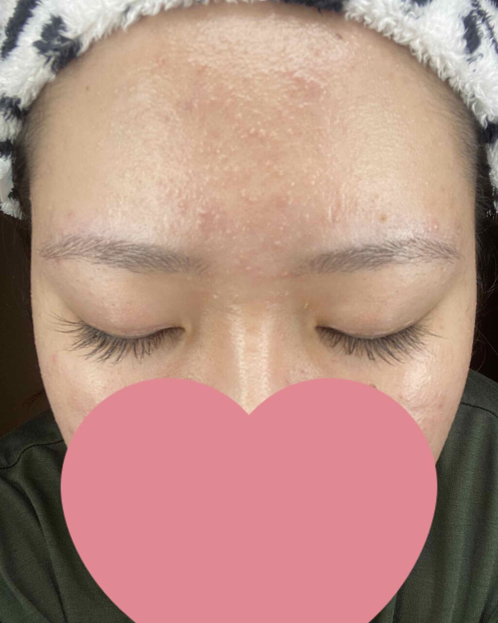 アイラッシュセラム/PHOEBE BEAUTY UP/まつげ美容液を使ったクチコミ(1枚目)