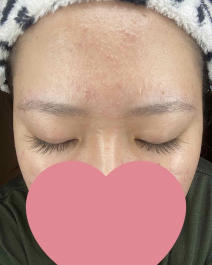 アイラッシュセラム/PHOEBE BEAUTY UP/まつげ美容液を使ったクチコミ(1枚目)