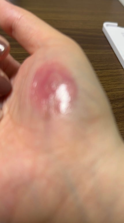 ウォンジョンヨ フォンダンリップ/Wonjungyo/口紅を使ったクチコミ(2枚目)