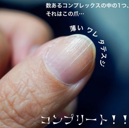 ネイルリペアクリーム/LUCIA/ネイルオイル・トリートメントを使ったクチコミ(2枚目)