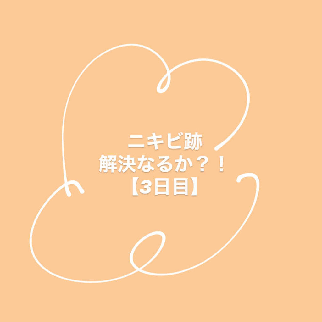 AHA·BHA·PHA 30デイズミラクルトナー/SOME BY MI/化粧水を使ったクチコミ（1枚目）