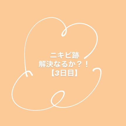 AHA·BHA·PHA 30デイズミラクルトナー/SOME BY MI/化粧水を使ったクチコミ(1枚目)