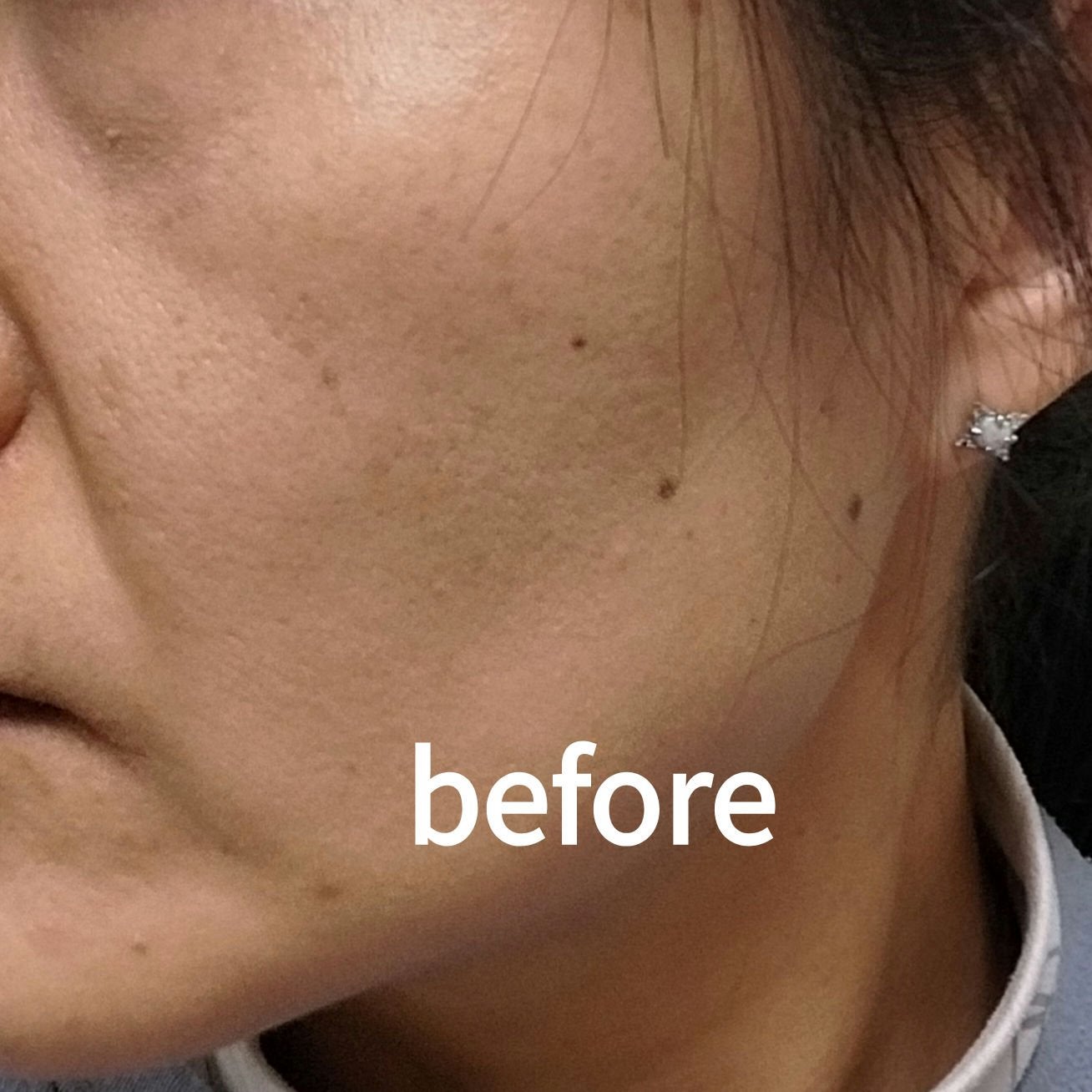 ユース ラディアンス ビタチノール セラム/primera/美容液を使ったクチコミ(3枚目)