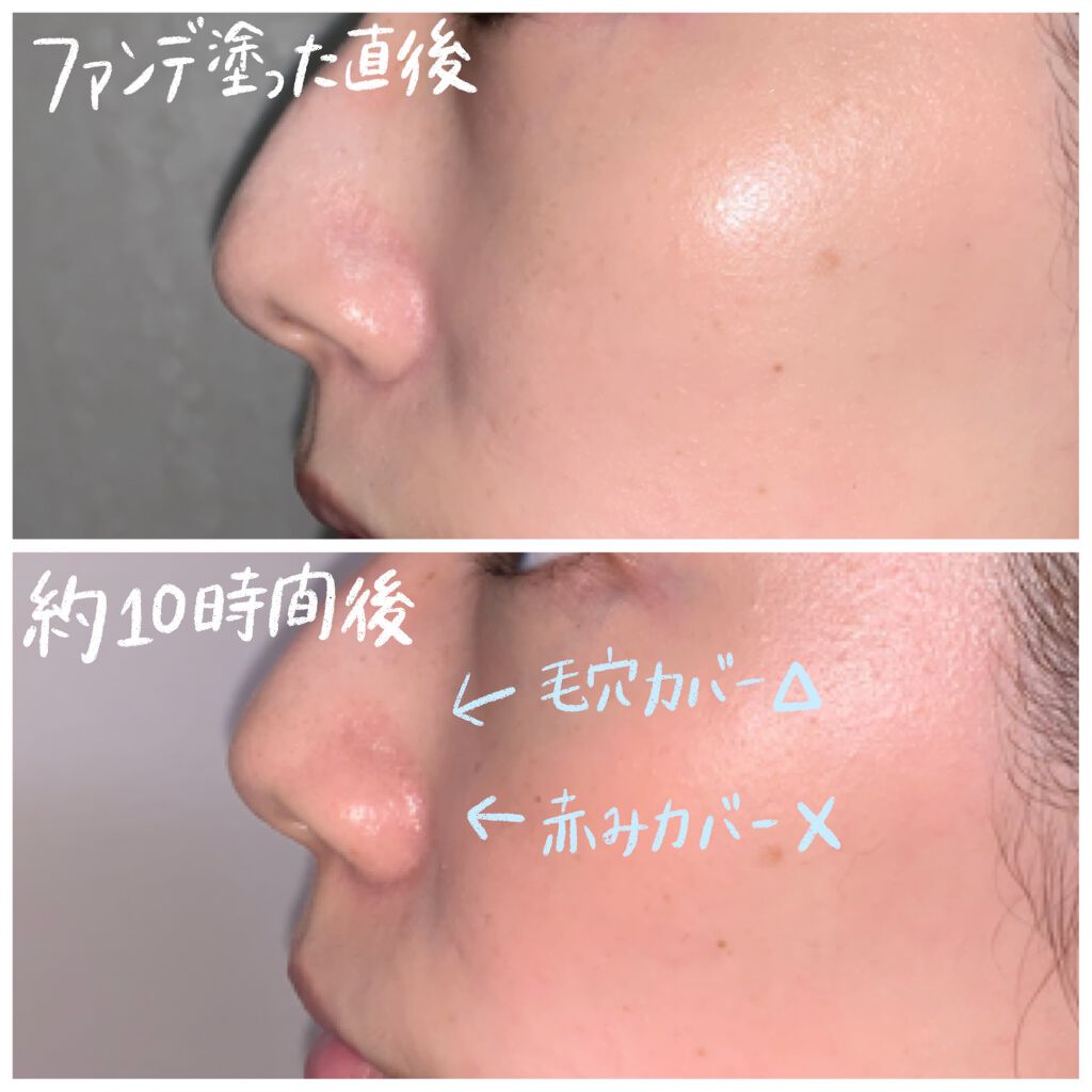 V3 エキサイティングファンデーション/SPICARE/クッションファンデーションを使ったクチコミ(5枚目)