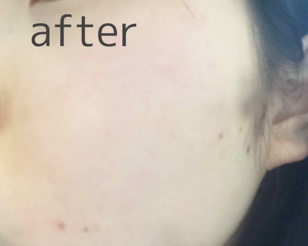 白潤 薬用美白乳液/肌ラボ/乳液を使ったクチコミ（3枚目）