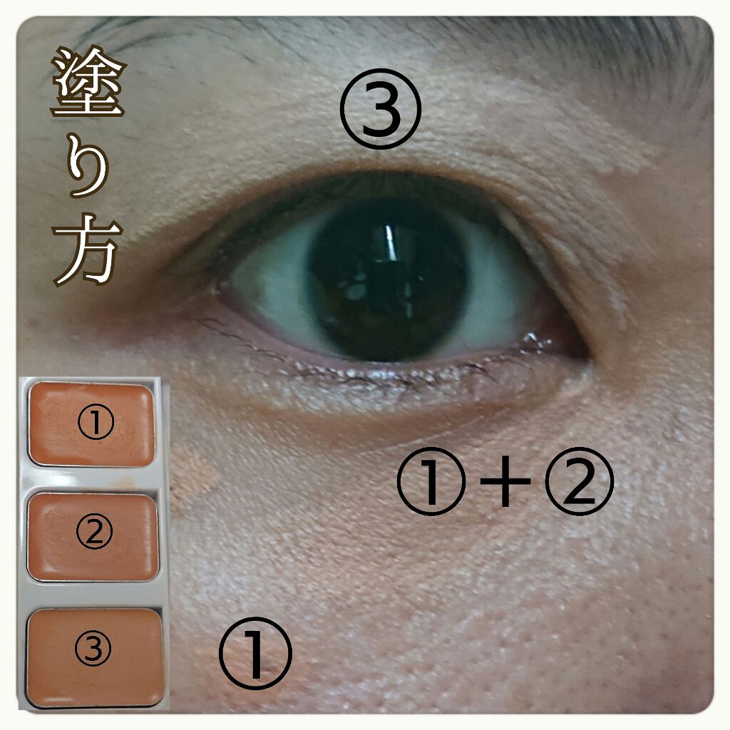 シミ隠しマジックパレット/シミウス/パレットコンシーラーを使ったクチコミ(5枚目)