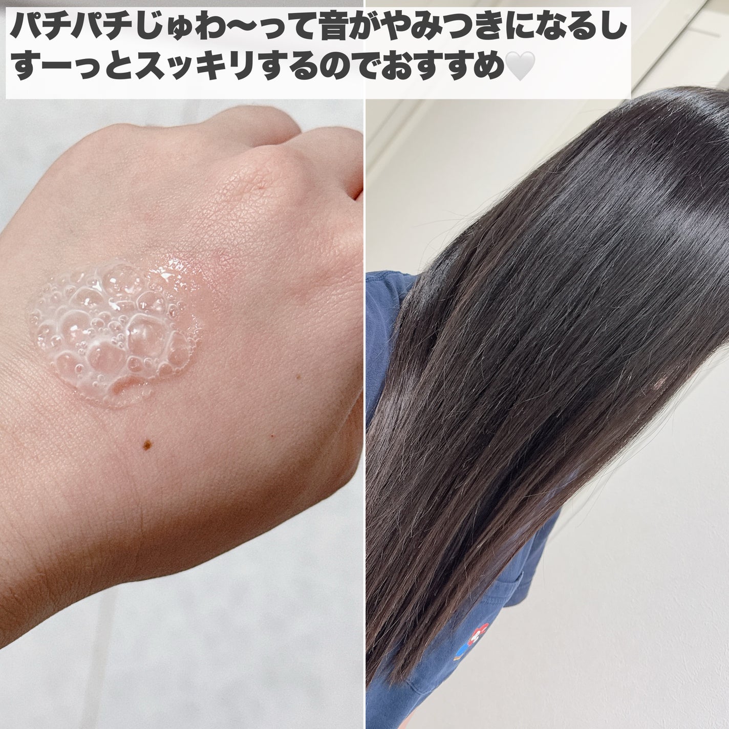 リフケア頭皮用炭酸美容液/emoc/頭皮トリートメントを使ったクチコミ(5枚目)