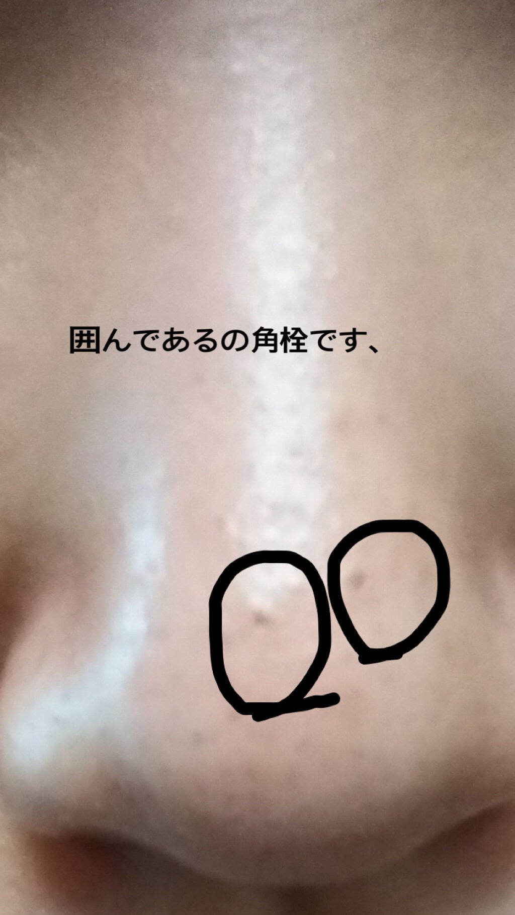 デュオ ザ クレンジングバーム クリア/DUO/クレンジングバームを使ったクチコミ(2枚目)