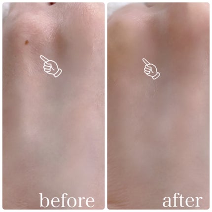 Ruu on LIPS 「TFIT(ティーフィット)コンシーラーこちらの3色のコンシーラ..」(4枚目)