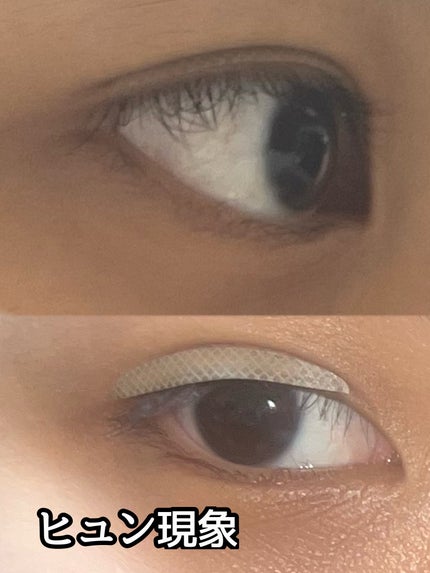 ぱっちり幅広アイテープ/DAISO/二重まぶた用アイテムを使ったクチコミ(3枚目)