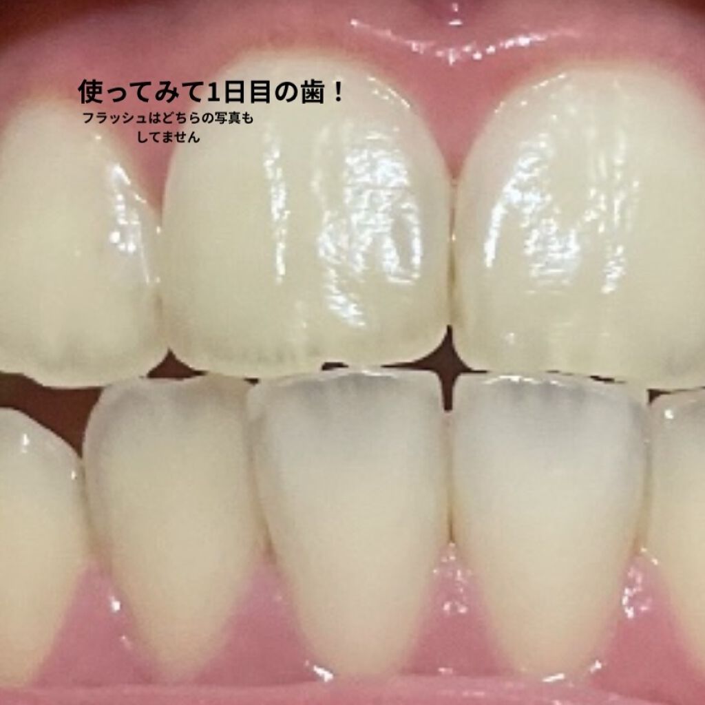 NONIOプラスホワイトニングハミガキ/NONIO/歯磨き粉を使ったクチコミ（3枚目）