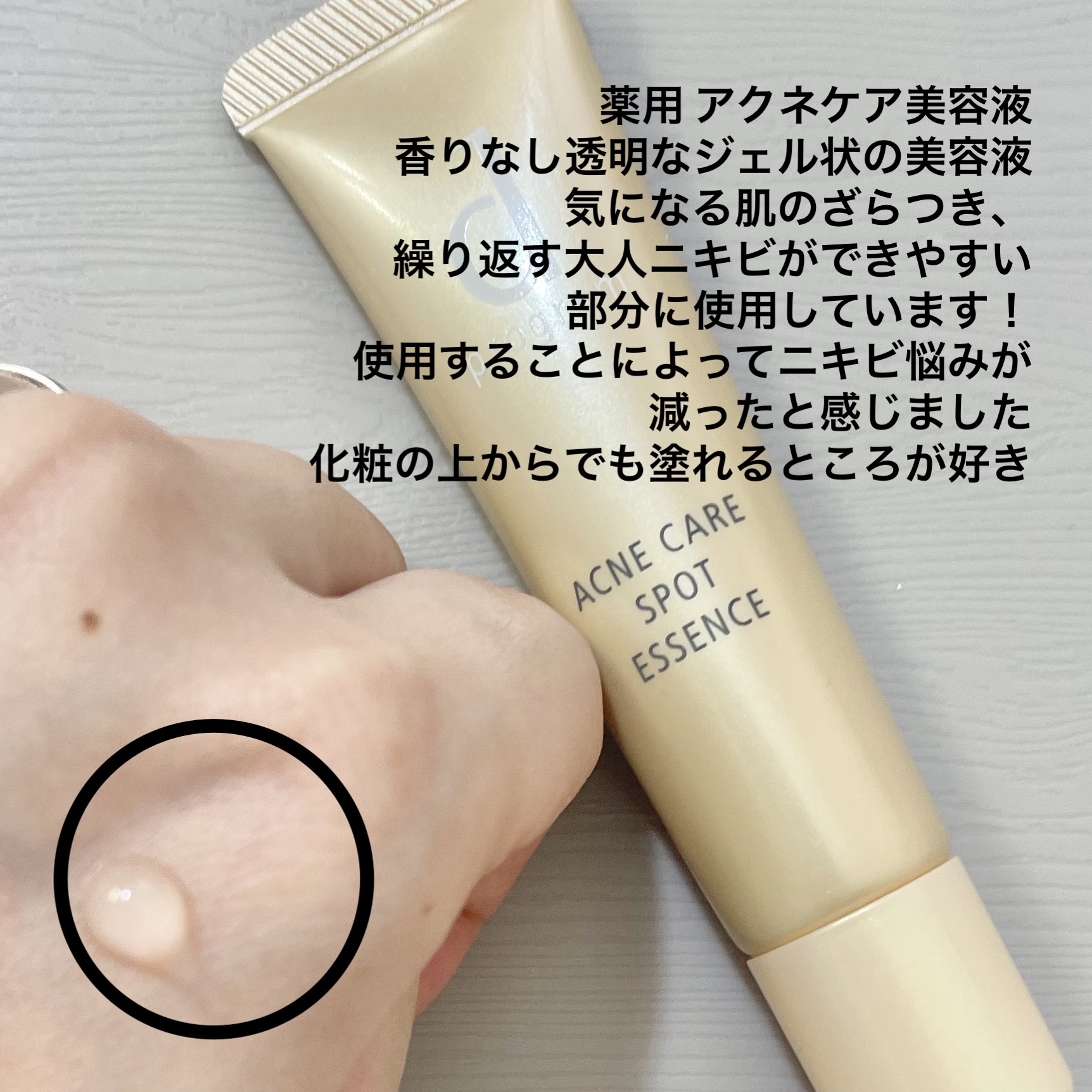 薬用 アクネケア美容液/d プログラム/美容液を使ったクチコミ（2枚目）