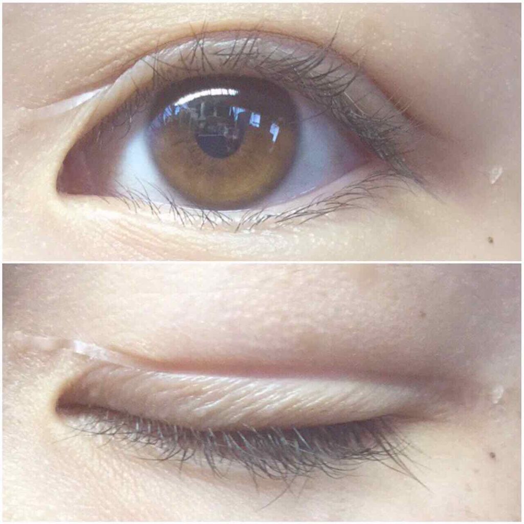 のびーるアイテープ（絆創膏タイプ、レギュラー）/DAISO/二重まぶた用アイテムを使ったクチコミ（2枚目）