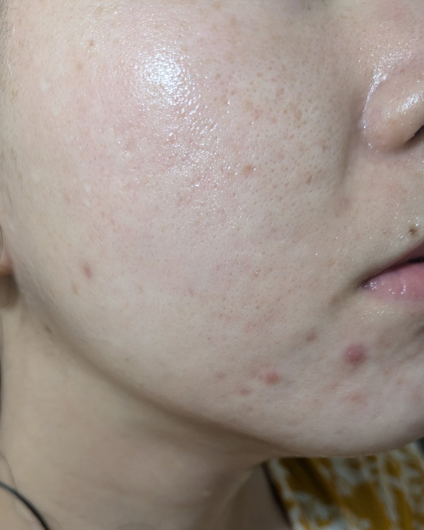 AHA 30% + BHA 2% Peeling Solution/The Ordinary/ピーリングを使ったクチコミ(1枚目)