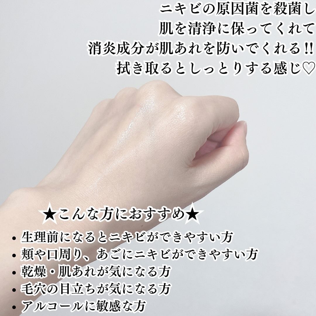 アキュネ 薬用ふきとりローションU/アキュネ/拭き取り化粧水を使ったクチコミ(4枚目)