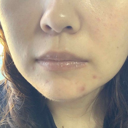 クリアラスト フェイスパウダー N 薬用美白オークル/クリアラスト/プレストパウダーを使ったクチコミ(3枚目)