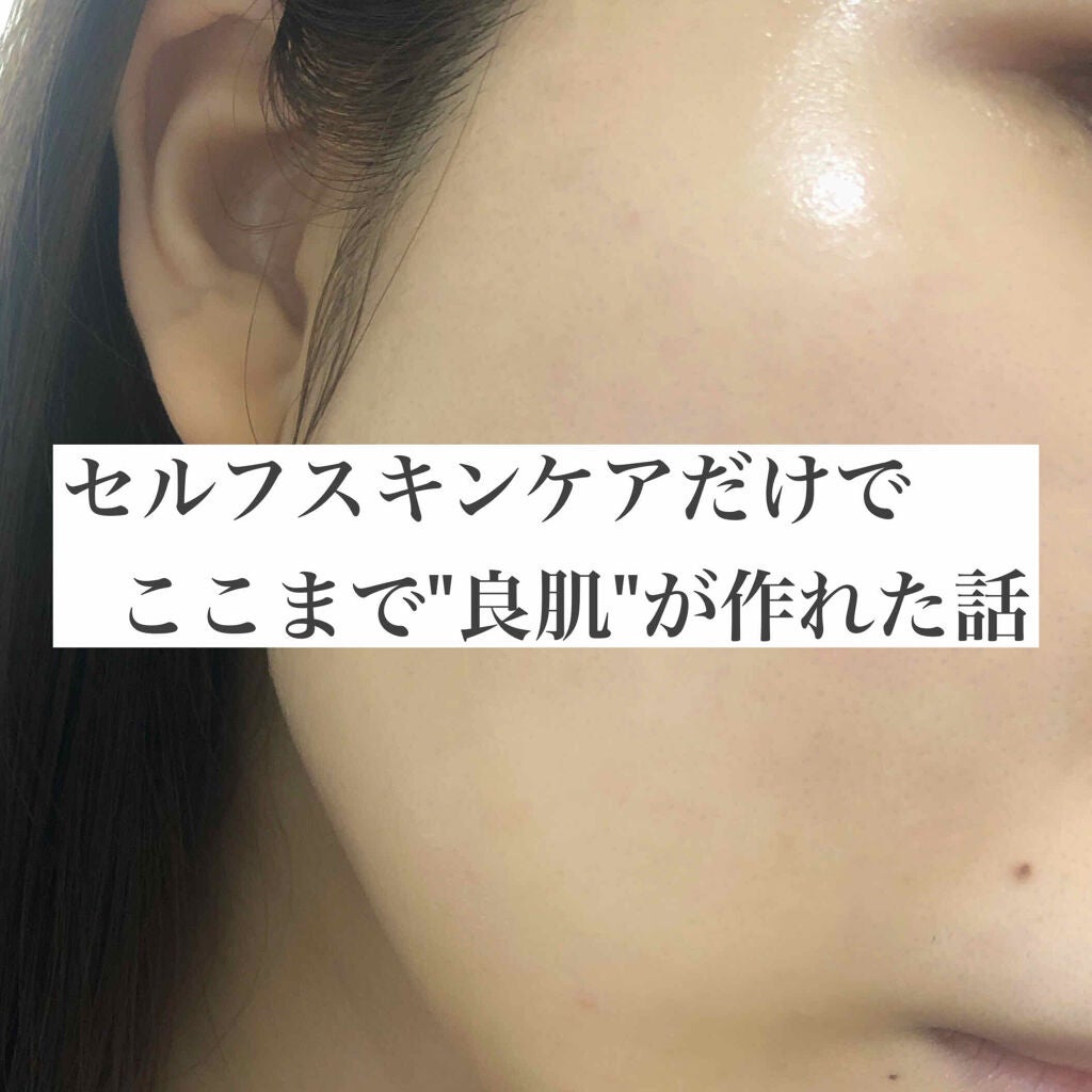 Yuyu on LIPS 「【揺るがない健康なツヤ肌】になりたくてやったこと6選※写真は夜..」(1枚目)