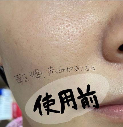 ザビタミンC23/IOPE/美容液を使ったクチコミ(3枚目)