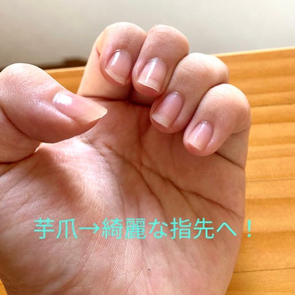 グロウケアコート/デュカート/ネイルオイル・トリートメントを使ったクチコミ(1枚目)