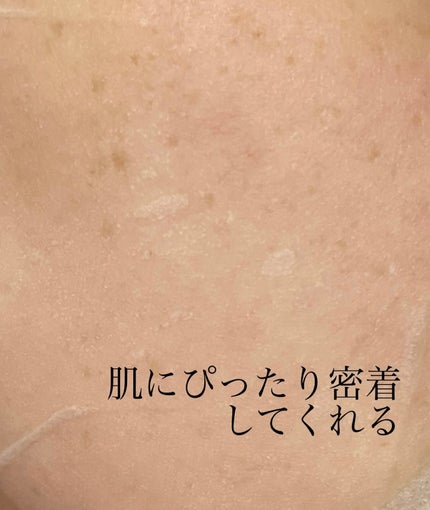 レッドブレミッシュクイックPHAシートマスク/Dr.G/シートマスク・パックを使ったクチコミ(5枚目)