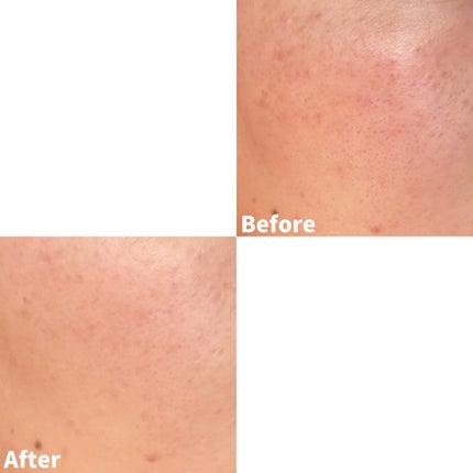 ウルトラカバー UV パクト/CEZANNE/パウダーファンデーションを使ったクチコミ(6枚目)