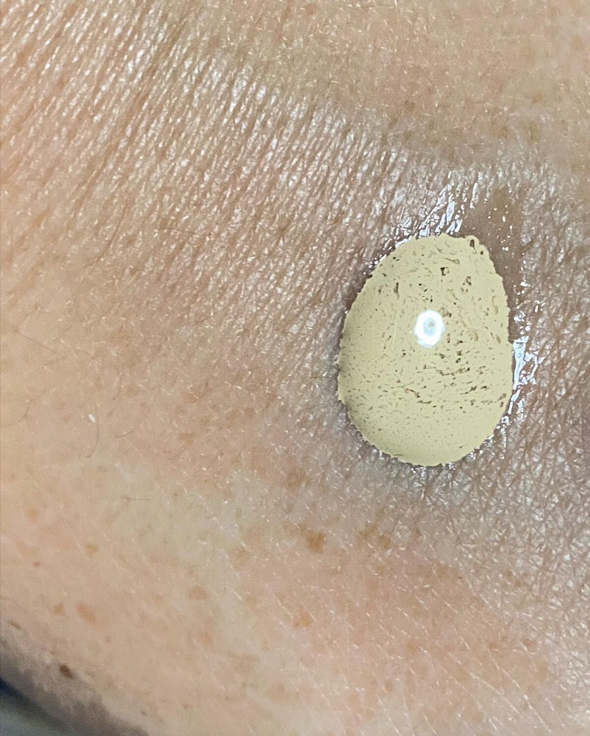 タンイドル ウルトラ ウェア リキッド/LANCOME/リキッドファンデーションを使ったクチコミ(5枚目)